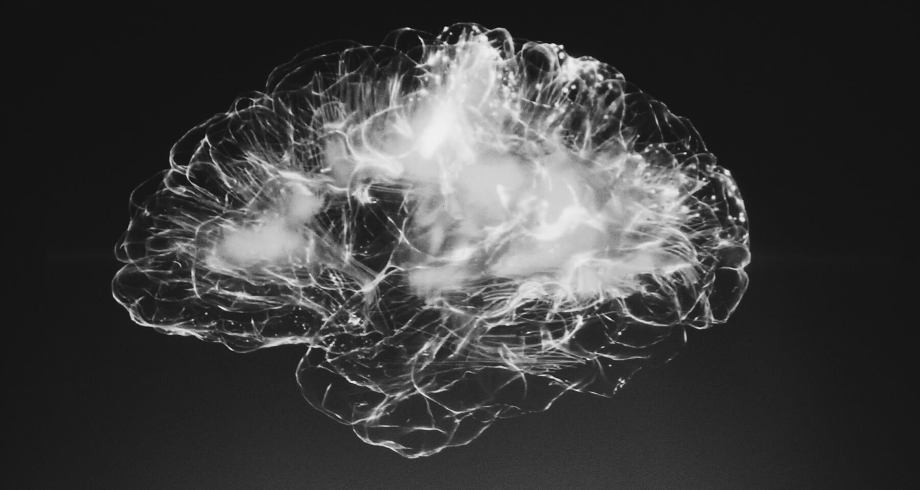 White-on-black image of an MRI scan.